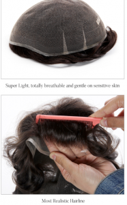 hairline